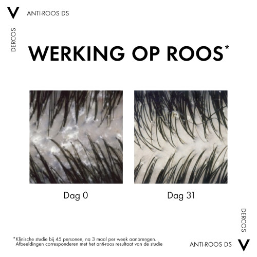 Vichy Dercos Anti-Roos Shampoo 390ml