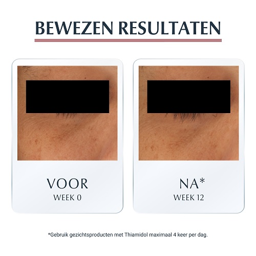 Eucerin Anti-Pigment Verhelderende Oogcontourcrème 15ml